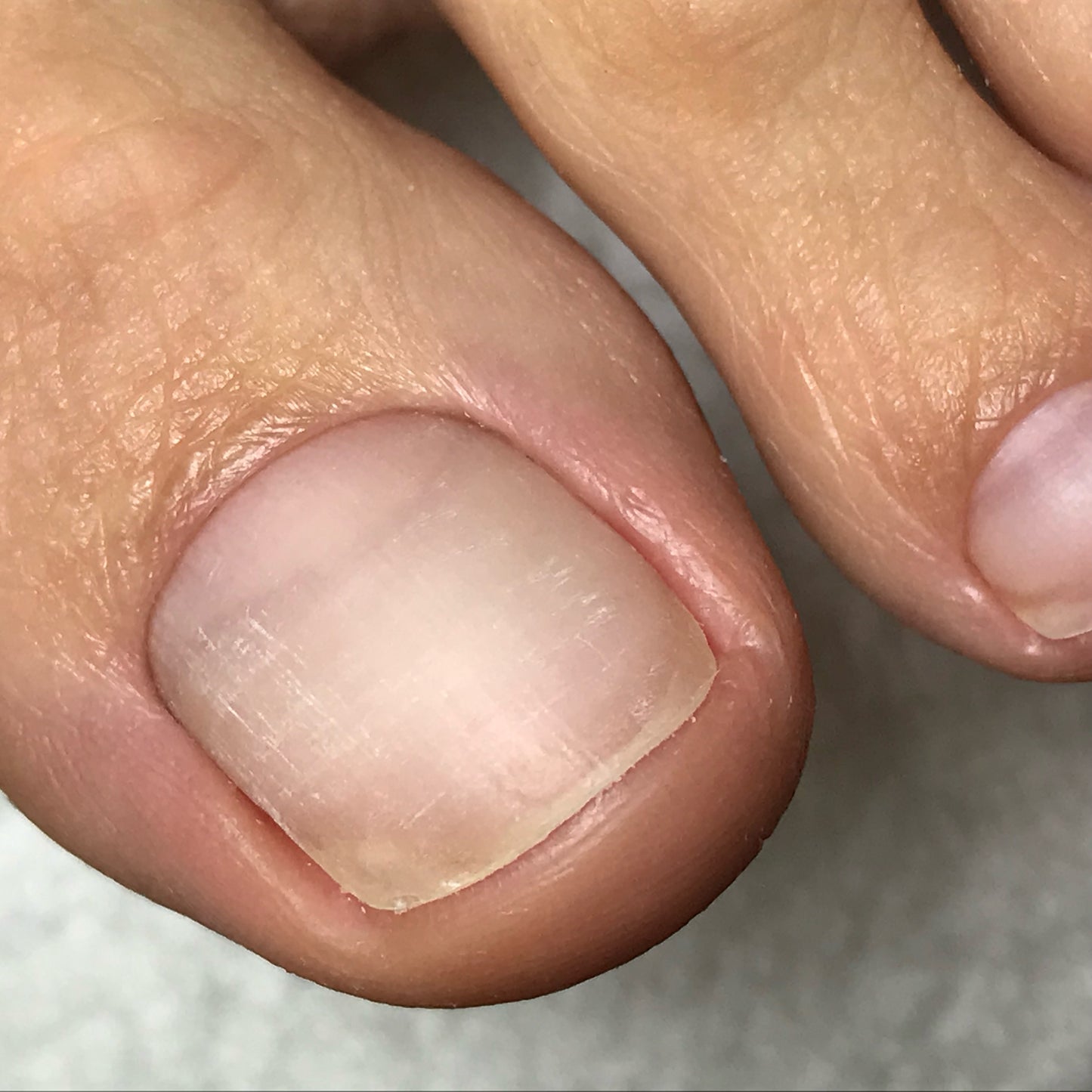 VANCOUVER:
EURONAILS STANDARD PEDICURE COURSE (with PODODISC) LEVEL 1