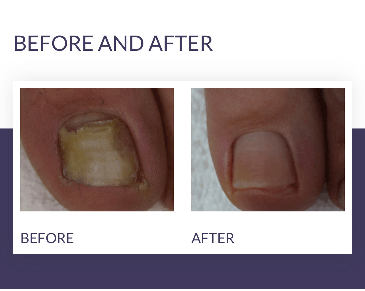 FOOTLOGIX® TOE NAIL TINCTURE SPRAY