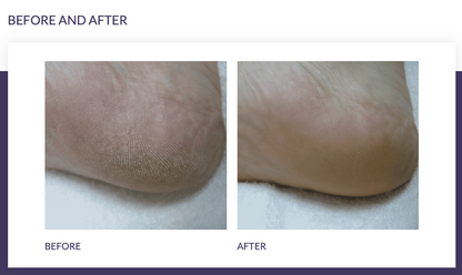 FOOTLOGIX® DAILY MAINTENANCE FORMULA