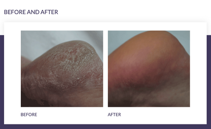 FOOTLOGIX® DD CREAM MOUSSE FORMULA