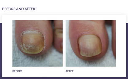 FOOTLOGIX® CUTICLE SOFTENER PROFESSIONAL 118 ML / 4 FL OZ